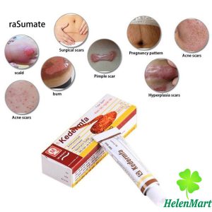 Kedermfa Tube 5gm Vietnam Remove Scar Cream 5gr - Free ship