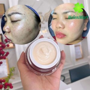 N23 Duyen Thi Cream N23 Duyen Thi Cream Rejuvenate, whiten skin, fade melasma, reduce acne 25gr
