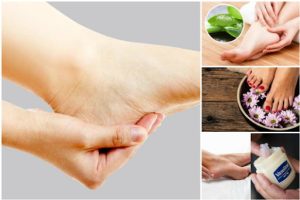 Simple Remedies for Cracked Heels Using Natural Ingredients