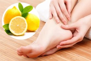Let’s explore Some Simple Remedies for Cracked Heels Using Natural Ingredients with Helenmart to ease your worries!